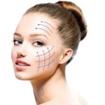 أضرار عملية شد الوجه