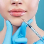 مخاطر نفخ الشفاه