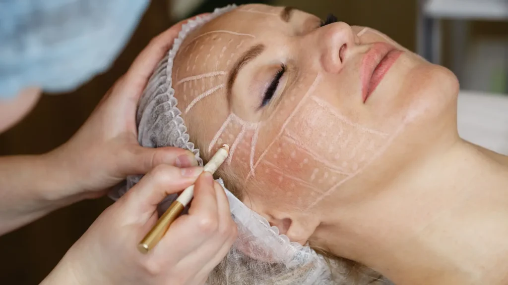 مضاعفات شد الوجه الجراحي