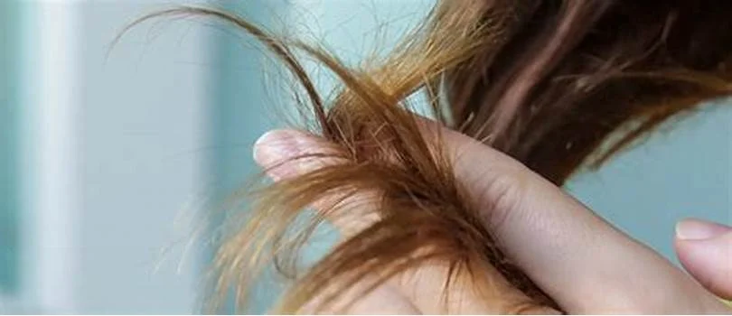 أفضل الطرق لعلاج تقصف الشعر الشديد واستعادة حيويته 2 علاج تقصف الشعر الشديد