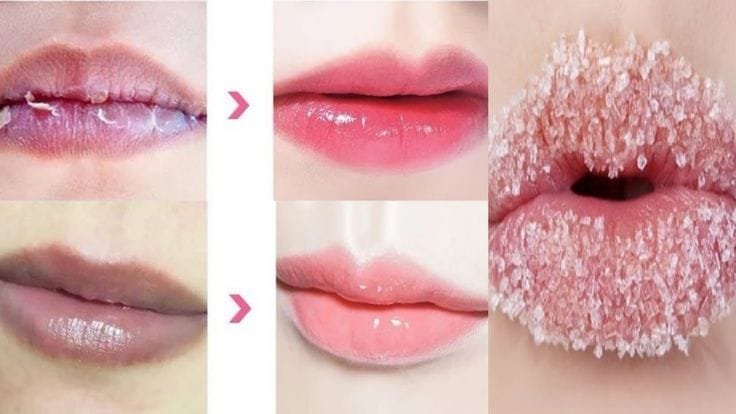 طرق طبيعية لتقشير الشفاه والحفاظ على نعومتها 1 تقشير الشفاه