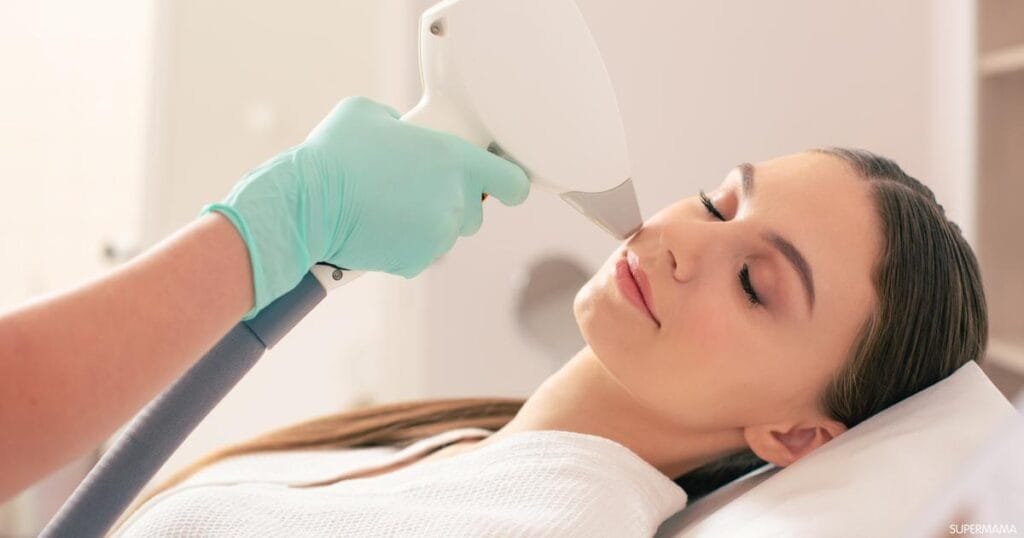 إزالة الشعر بالليزر