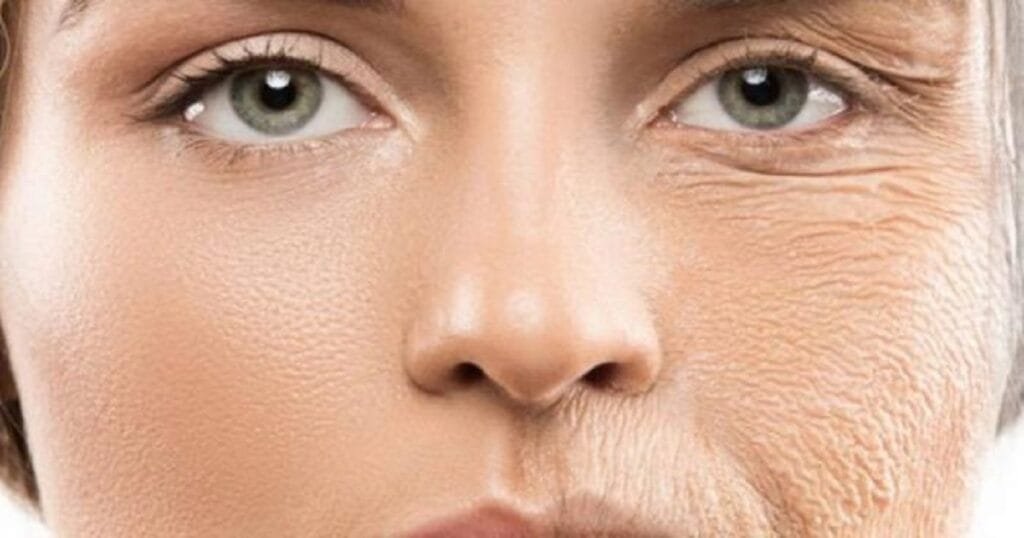 كريم لشد البشرة