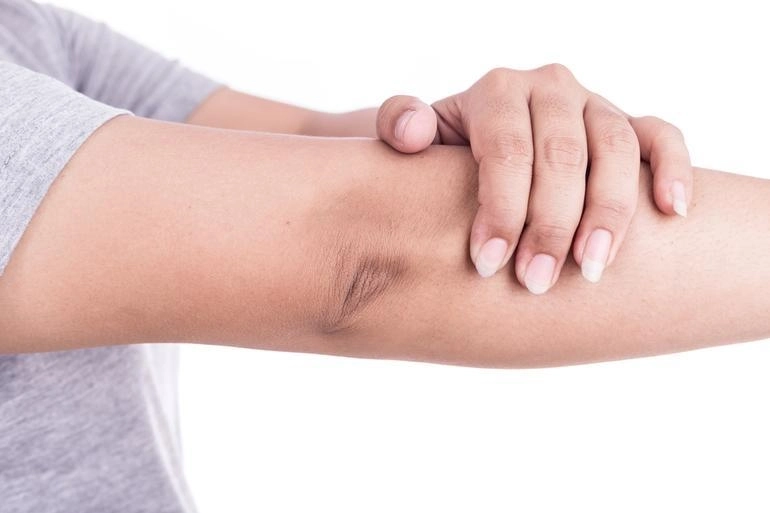 كريم لتفتيح الركب والأكواع