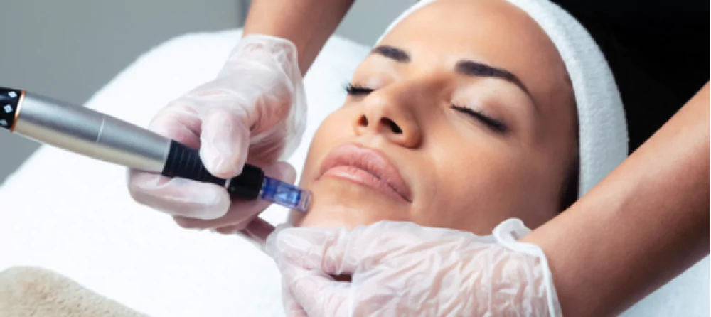 علاج الهالات بالميزوثيرابي